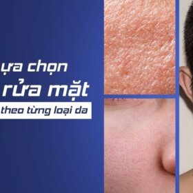 Lựa chọn sữa rửa mặt cho từng loại da